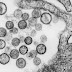 Hantavirus : Is it similar to CoronaVirus (Covid19)? Read This.