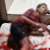 Vídeo: Jovem é alvejado no meio da rua durante madrugada na Redenção