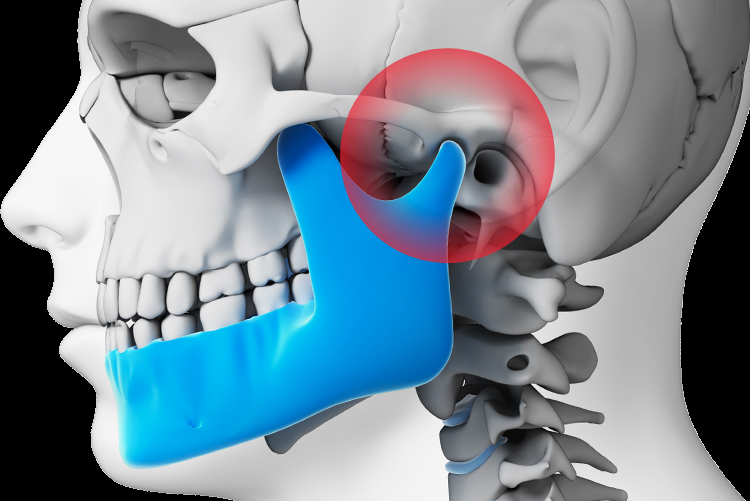 TMJ Disorder And Facial Pain ~ Dr. Bharat Katarmal Dental & Implant Clinic