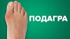 Лечение подагры в Одессе и Удаление косточки на ноге Одесса