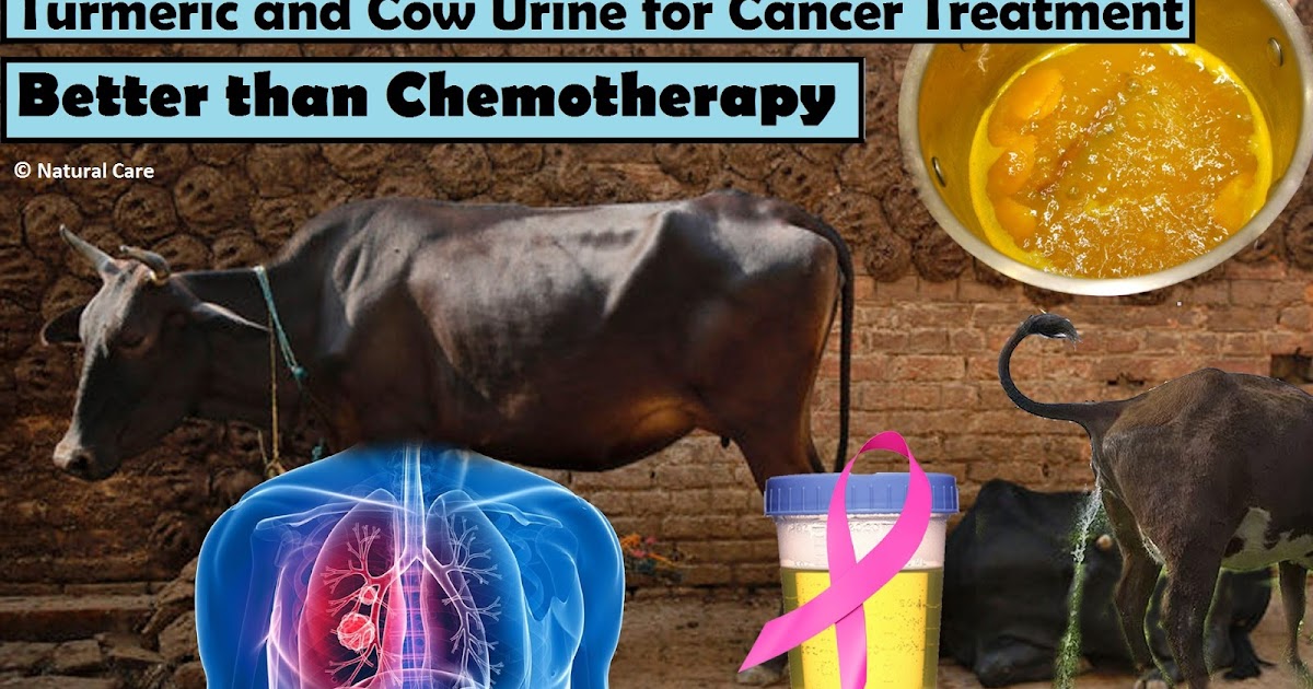 Turmeric and Cow Urine for Cancer Treatment Better than Chemotherapy