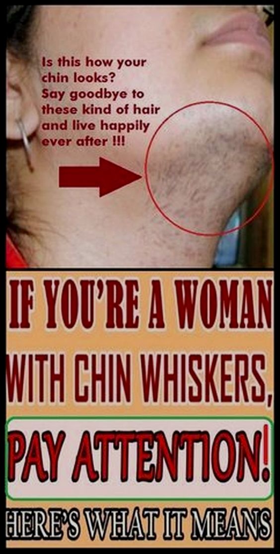 Female whiskers on chin Clearance