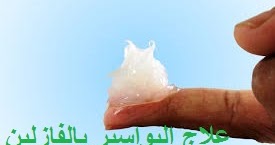 علاج البواسير بالفازلين وبالادوات المنزلية