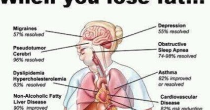 How Your Body Is Benefited When You Lose Fat?