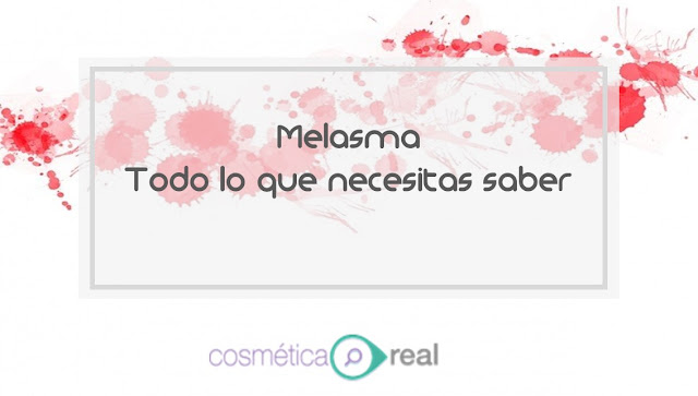 Que es el Melasma: Todo lo que necesitas saber.