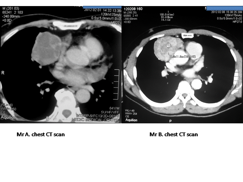 VIETNAMESE MEDIC ULTRASOUND CASE 188 MEDIC RADIOLOGY CASE 5 THYMOMA