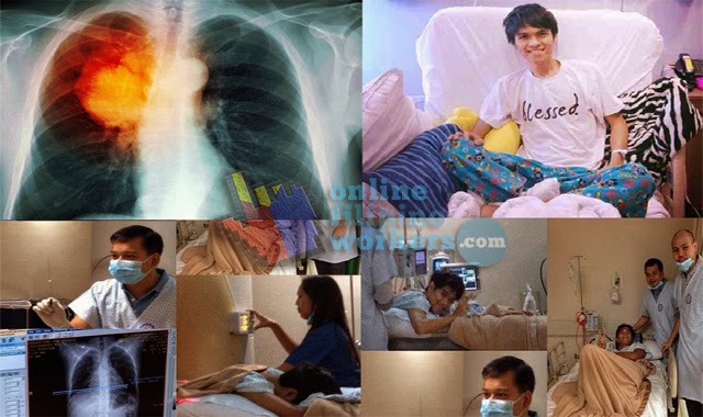 Jam Sebastian is Dead What Causes His Lung Cancer?