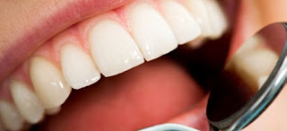 ¿Qué es una endodoncia y cuándo es necesaria? ¿Qué es una endodoncia y cuándo es necesaria?