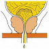 Incontinence urinaire : vessie neurogène, causes traitement