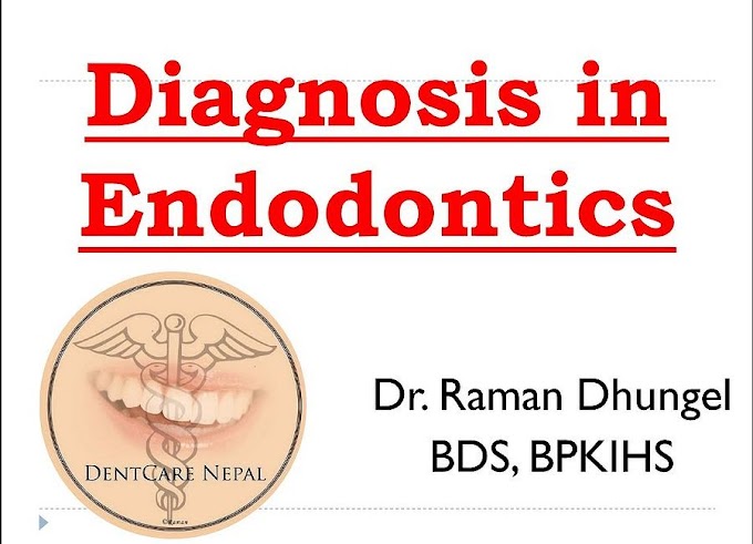 Diagnosis in ENDODONTICS: Dental Powerpoint Presentation - Dr. Raman Dhungel