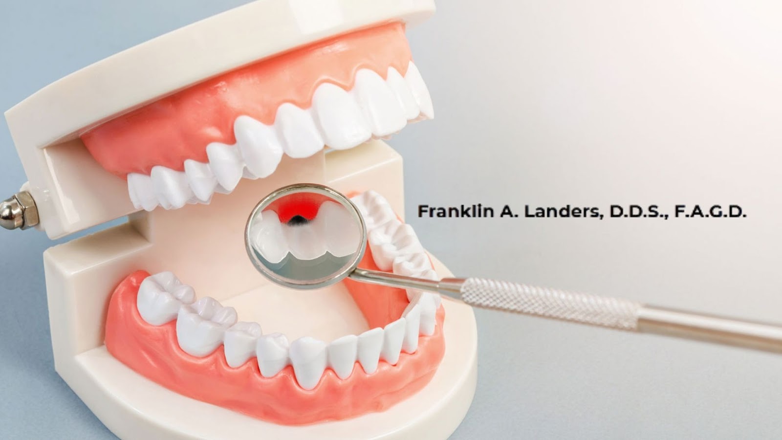 Dental Services Use Of Artificial Fixture To Set Strong Dental Ability