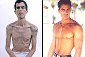 anorexia en hombres