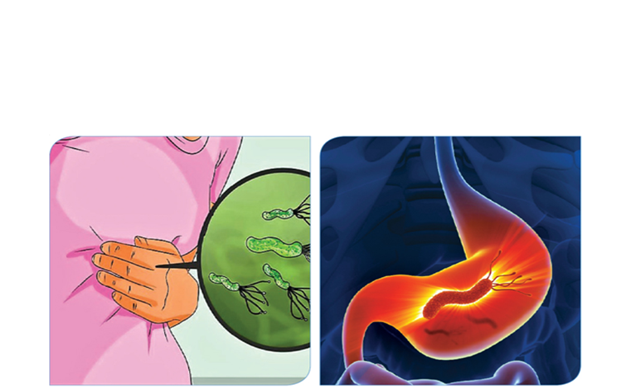 الميكروب الحلزونى أسبابه أعراضه علاجه الميكروب الحلزونى أسبابه أعراضه علاجه