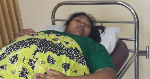 Operasi Sesar Bayi Kembar Ibu Nur Kholilah CAHAYA Foundation