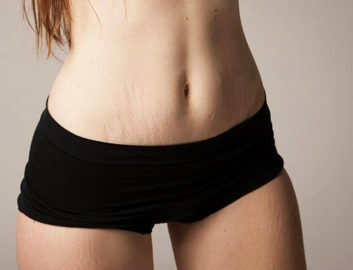 A Photographer Shows How Female Bodies Truly Look Like After Pregnancy A Photographer Shows How Female Bodies Truly Look Like After Pregnancy