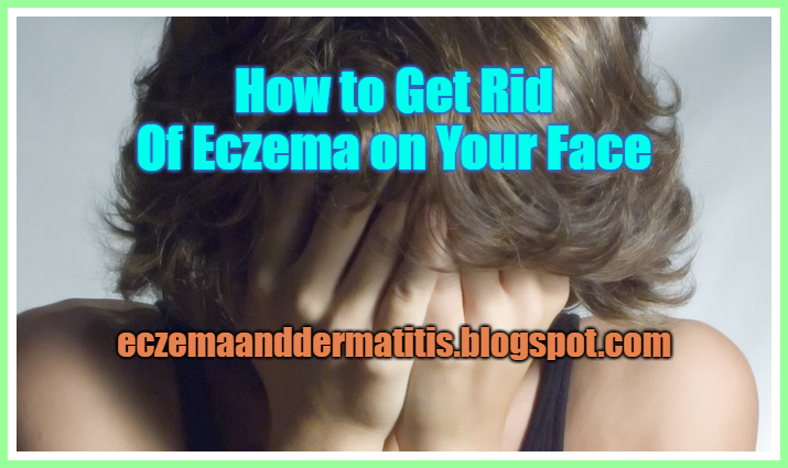 How To Get Rid Of Eczema On Your Face Eczema And Dermatitis