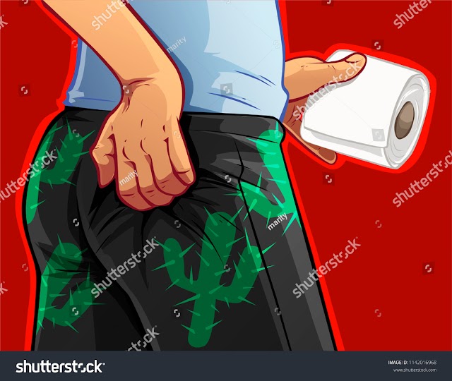 Itchy Hemorrhoids : Best Tips For You To Stop Itchy Hemorrhoids.