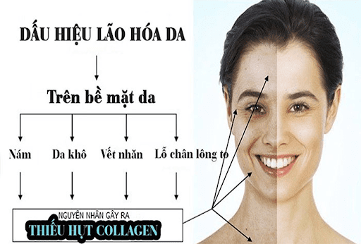 Những nguyên nhân dẫn đến tình trạng suy giảm Collagen. Những nguyên nhân dẫn đến tình trạng suy giảm Collagen.
