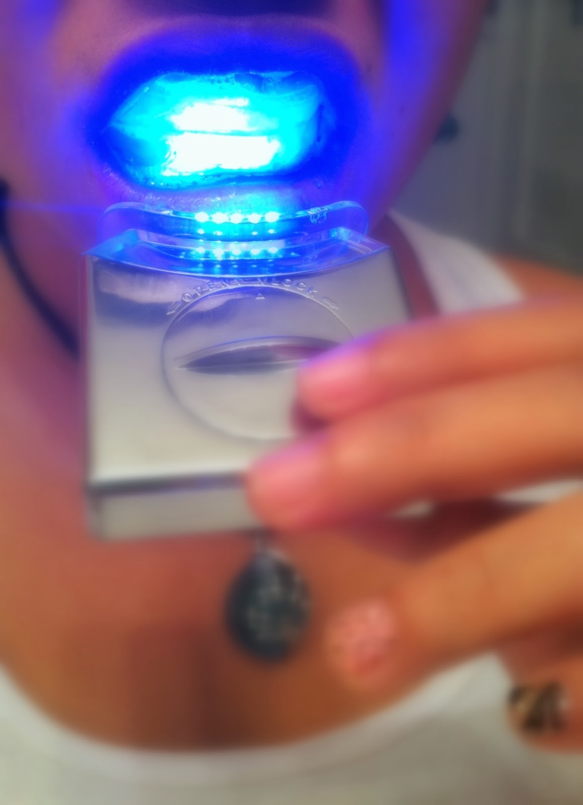 Life's Perception & Inspiration Review & Giveaway LED Teeth Whitening