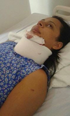Marcelino Vieira-RN: ex-esposa de vereador sofre acidente automobilístico!