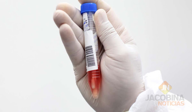 Caldeirão Grande confirma primeiro caso de coronavírus