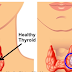 How To Easily Check If You Have Thyroid Disease