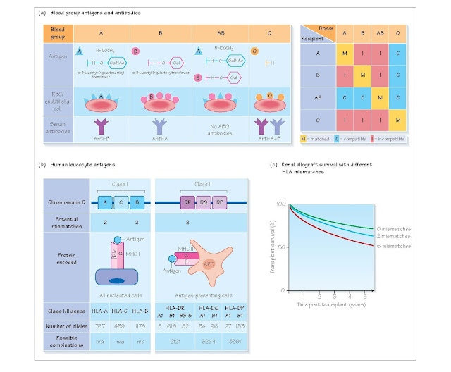 Tissue Typing And HLA Matching pediagenosis