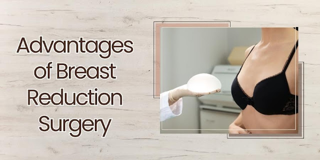 Advantages of Breast Reduction Surgery