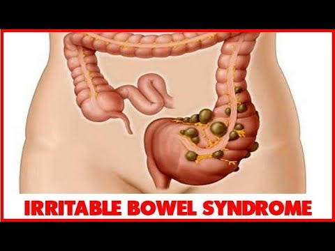 irritable bowl syndrome symptoms and causes