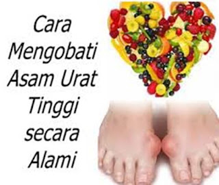 Asam Urat Bisa Disembuhkan Atau Tidak, Asam Urat Nyeri Leher, Obat Asam Urat Secara Tradisional, Obat Sakit Asam Urat Secara Alami, Buah Hindari Asam Urat, Obat Penyembuh Sakit Asam Urat, Asam Urat Labu Siam, Obat Herbal Alami Mengatasi Asam Urat, Bagaimana Cara Menyembuhkan Asam Urat, Cara Mengobati Asam Urat Di Tangan, Asam Urat Gejala Dan Obat, Asam Urat Donor Darah, Makanan Menurunkan Asam Urat Dan Kolesterol, Asam Urat Di Telapak Kaki, Asam Urat Gejala Dan Pencegahannya, Penyebab Asam Urat Dan Cara Penanggulangannya, Fungsi Asam Urat Dalam Tubuh Manusia, Obat Asam Urat Rumahan, Alat Cek Gula Darah Kolesterol Dan Asam Urat Yang Bagus, Batas Normal Asam Urat Untuk Laki Laki, Obat Oles Alami Untuk Asam Urat, Asam Urat Makan Apa, Asam Urat Dan Sakit Kaki, Penderita Asam Urat Akut, Cara Mengobati Kolesterol Dan Asam Urat Secara Alami, Www.Obat Tradisional Asam Urat, Obat Asam Urat Yg Bengkak, Pengobatan Alami Asam Urat Dan Kolesterol, Penyebab Asam Urat Pada Ibu Menyusui, Penyebab Asam Urat Pada Lansia 