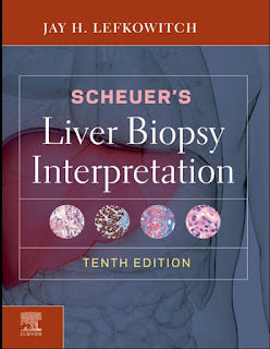 Scheuer’s Liver Biopsy Interpretation 10th Edition – 2021