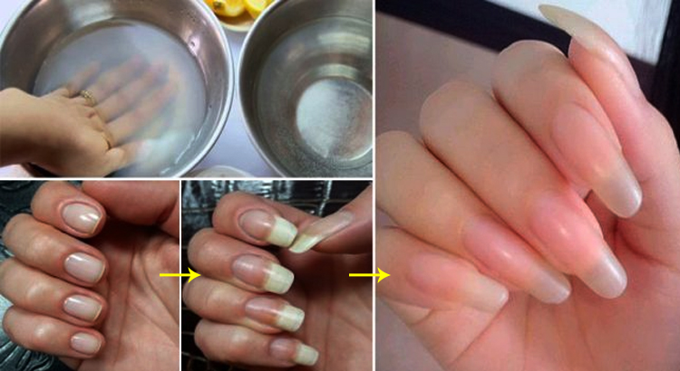 3 meilleures astuces maison pour faire pousser les ongles rapidement et naturellement