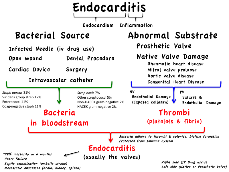 Infective Endocarditisdiagnosis And Treatment