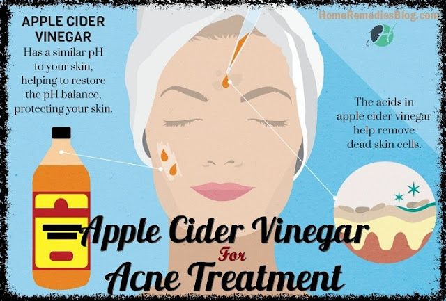 get rid of a painful pimple