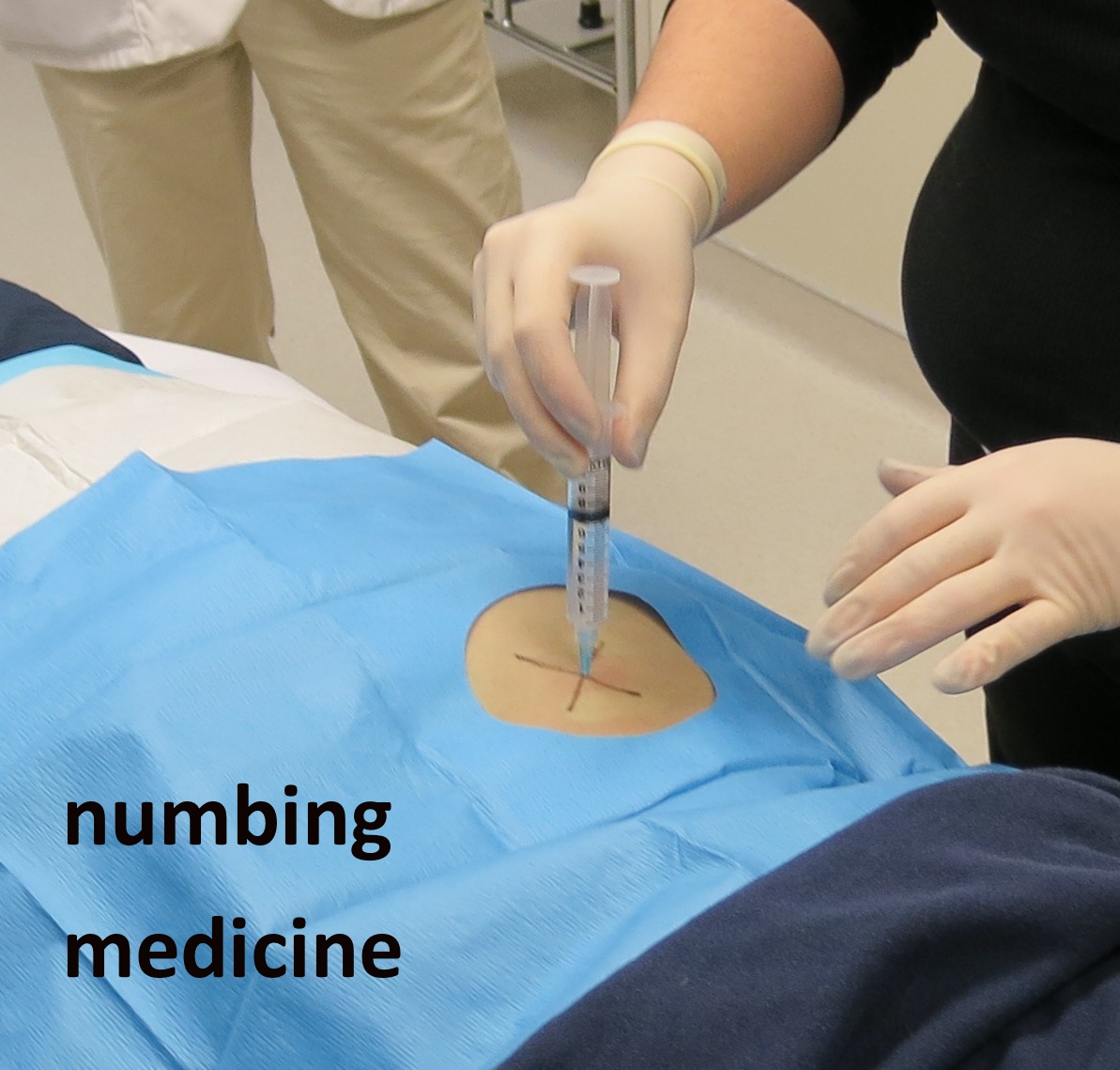 jm's Adventure with Multiple Myeloma: Bone Marrow Biopsy # 5 - WARNING