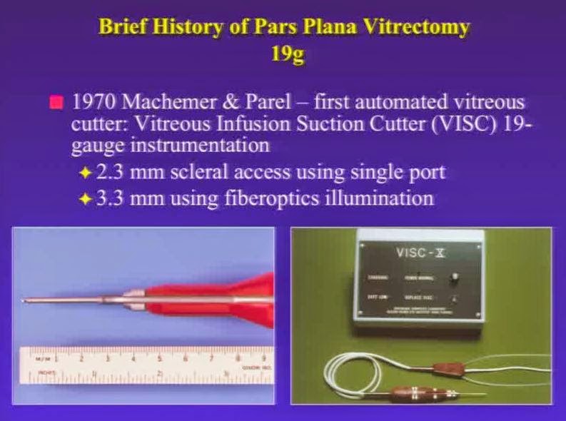 Ophthalmology OSCE: History of PPV