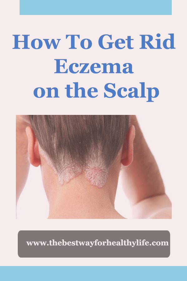 How To Get Rid Eczema on the Scalp Healthy Beauty