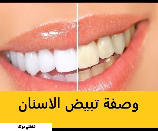 https://www.thqfnybook.com/2021/06/blog-post_2.html طرق تبييض الأسنان في المنزل