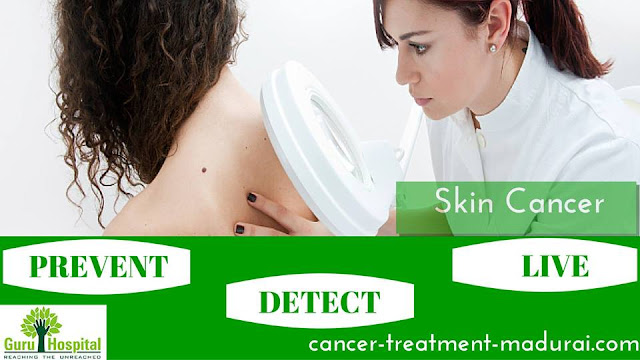 http://cancer-treatment-madurai.com/types-of-cancer-skin-cancer.php