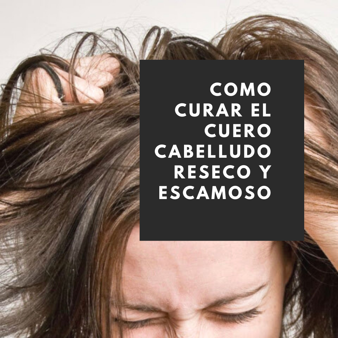Como Curar El Cuero Cabelludo Reseco Y Escamoso