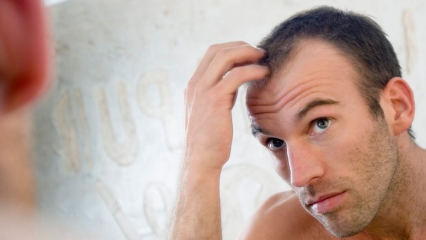 Does Dandruff Cause Hair Loss