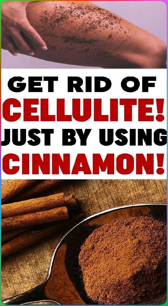 Get Rid Of Cellulite Use Cinnamon Wellness 2 Know