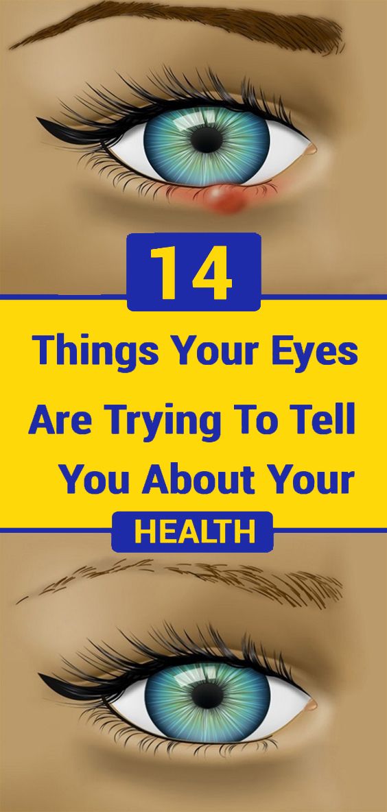 14 Things Your Eyes are Trying to Tell You About Your Health Healthy Will