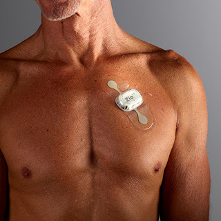 攜帶式心電圖機以偵測心悸