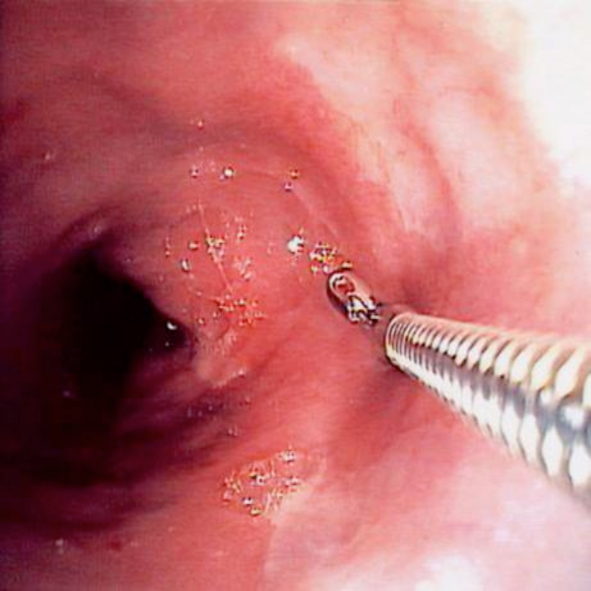 endoscopia2.jpg