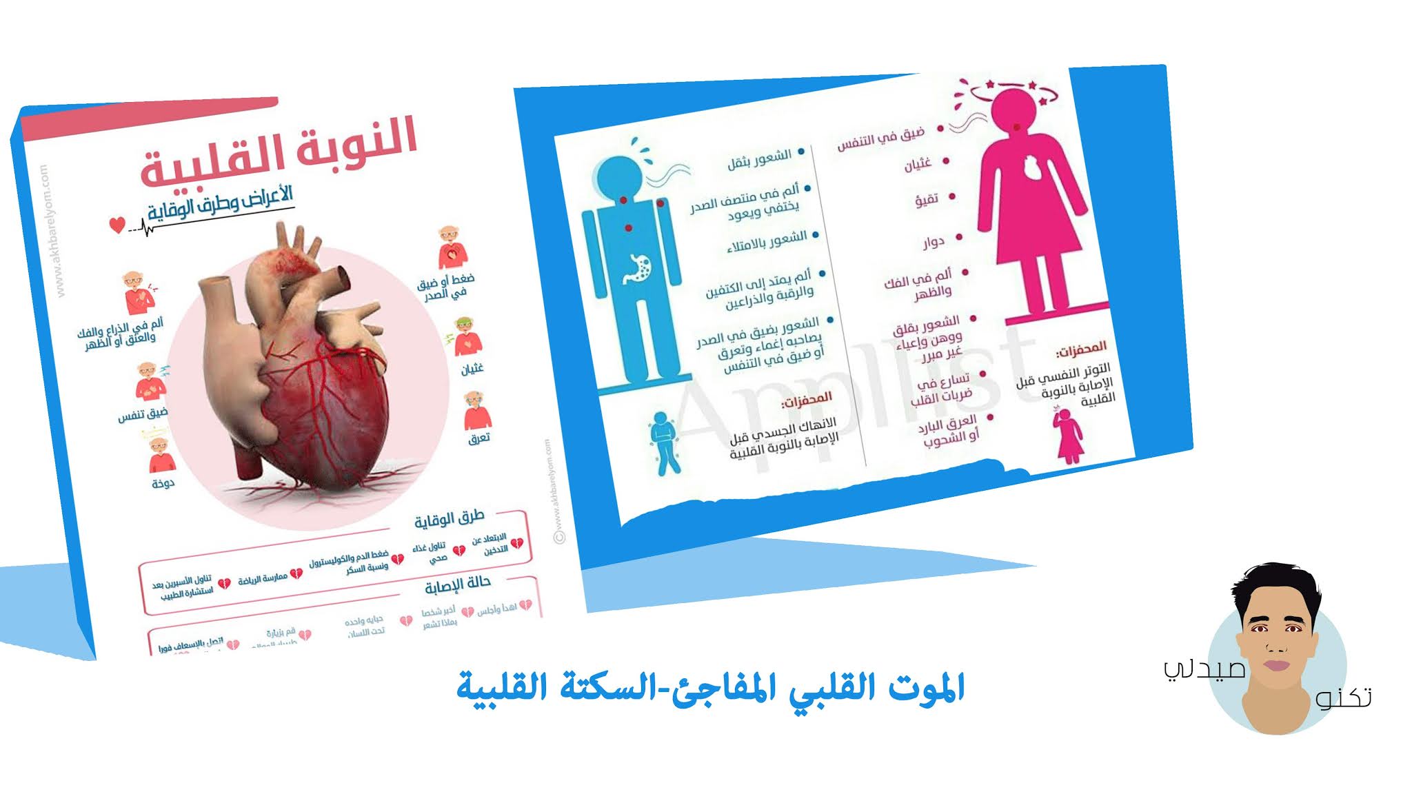 السكتة القلبية السكتة القلبية