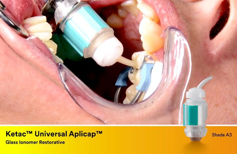 DENTAL MATERIALS Ketac Universal Aplicap 3M