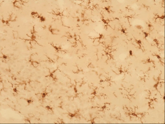 Микроглиоциты, «распределённые» по своим территориям для патрулирования в мозге: иммунофлюоресценция. Credit: medicalxpress.com