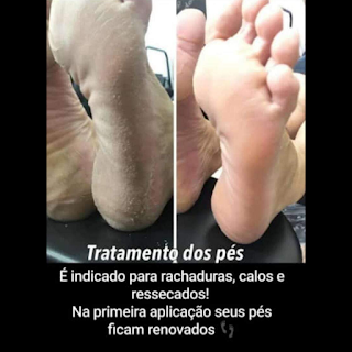 Tratamento podal Clearance