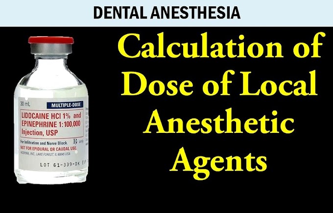 DENTAL ANESTHESIA: Dose Calculation of Lidocaine and Epinephrine